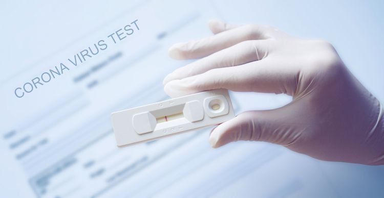 Domáci rýchlotest na koronavírus COVID-19