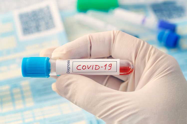 Liek na koronavírus nie je ešte dostupný