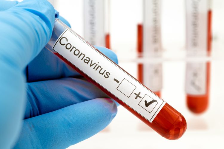 Aký je najlepší test na koronavírus?