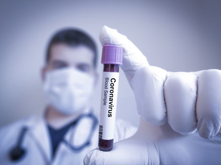 V USA údajne začali s testovaním vakcíny proti koronavírusu