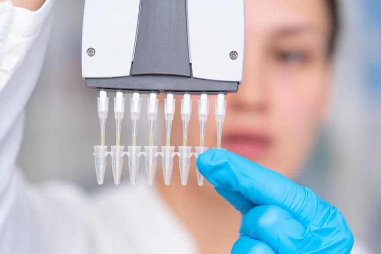 Testovanie na koronavírus PCR metódou
