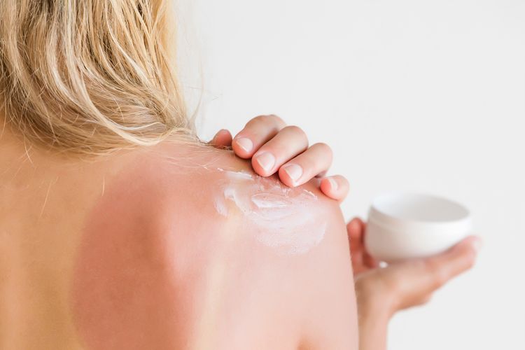 Tipy a rady, ako sa starať o pokožku po opaľovaní