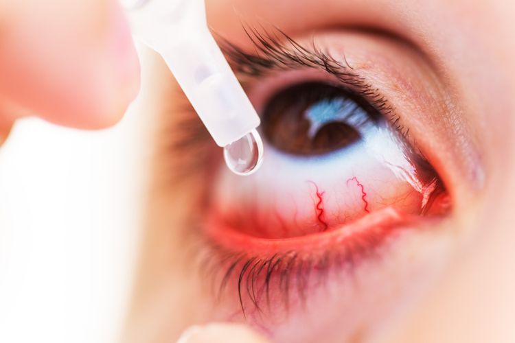 Voľne dostupné očné kvapky na infekcie