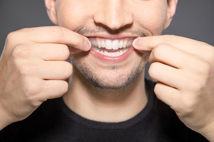 Bielenie zubov pomocou bieliacich pásikov Crest