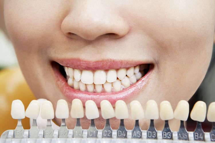 Kontrola belosti zubov
