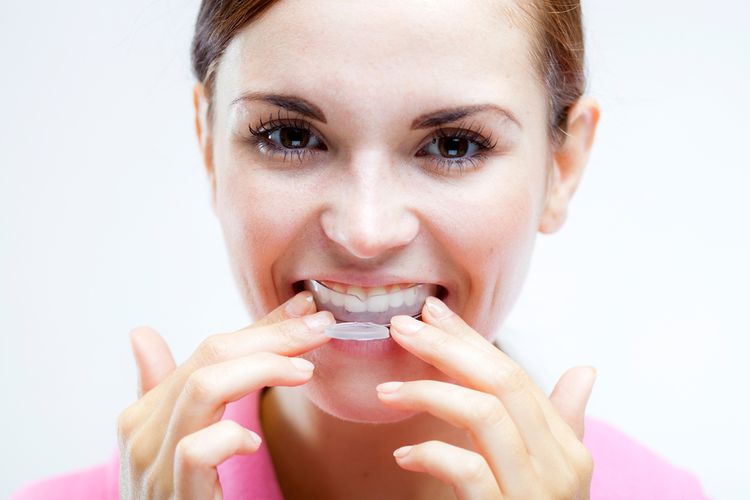 Procedúra bielenia zubov