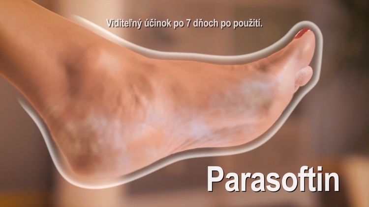 Účinky Parasoftinu
