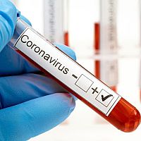 Testy na koronavírus – aké sú možnosti? Laboratórne testovanie, klinické či domáce rýchlotesty