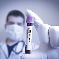 Vakcína proti novému koronavírusu? Začalo sa s testovaním