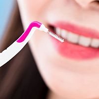 Čistenie medzizubných priestorov: medzizubné kefky a dentálne nite – veľkosti, použitie