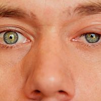 Jačmeň na oku – príčina, prenos a liečba. Masť je spôsob, ako sa ho zbaviť