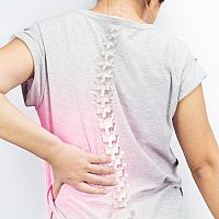 Osteoporóza – prevencia a liečba. Rady, ako zvýšiť hustotu kostí a doplniť vápnik