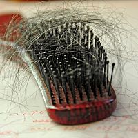 Domáce recepty na vypadávanie vlasov. Babské rady na jednom mieste