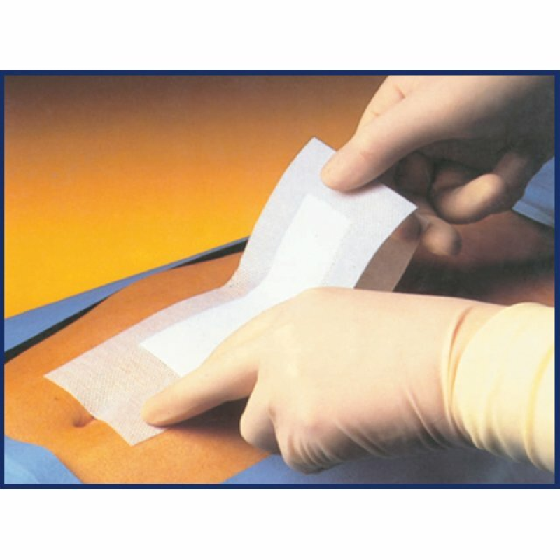 Pharmapore Samolepiaci sterilný obväz z netkanej textílie, 10x30cm, v balení 40ks TOW008143 Pharmapore Samolepiaci sterilný obväz z netkanej textílie, 10x30cm, v balení 40ks TOW008143