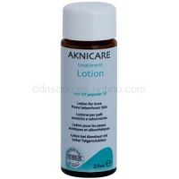 Synchroline Aknicare  lokálna starostlivosť proti akné pri seboroickej dermatitíde  25 ml