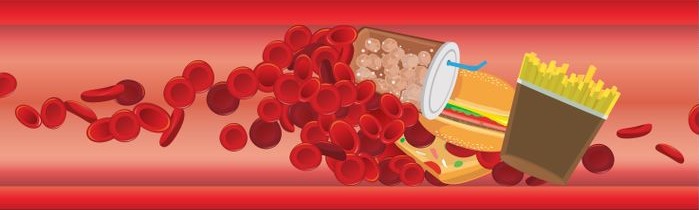 Vysoký cholesterol v krvi a nevhodné potreaviny